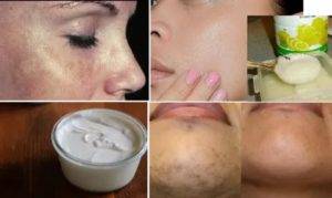Как отбелить загар лица в домашних условиях: лучшие домашние средства