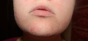 Почему тональное средство скатывается на лице, и как бороться с этой проблемой?