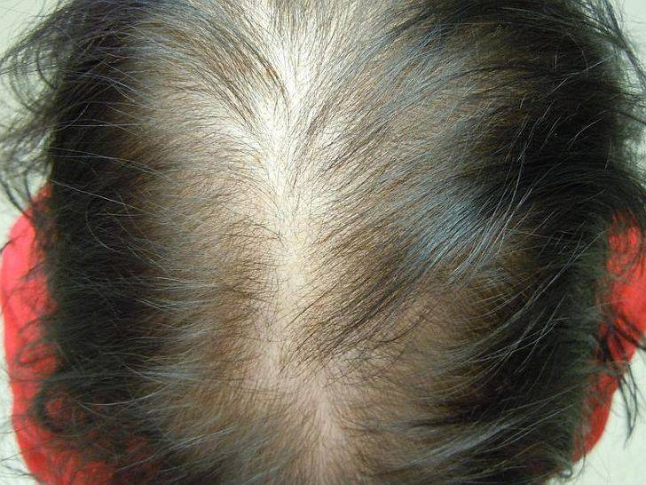 10 причин выпадения волос у женщин