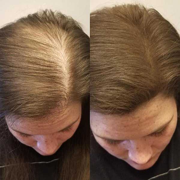 Стрижка для ускорения роста волос
