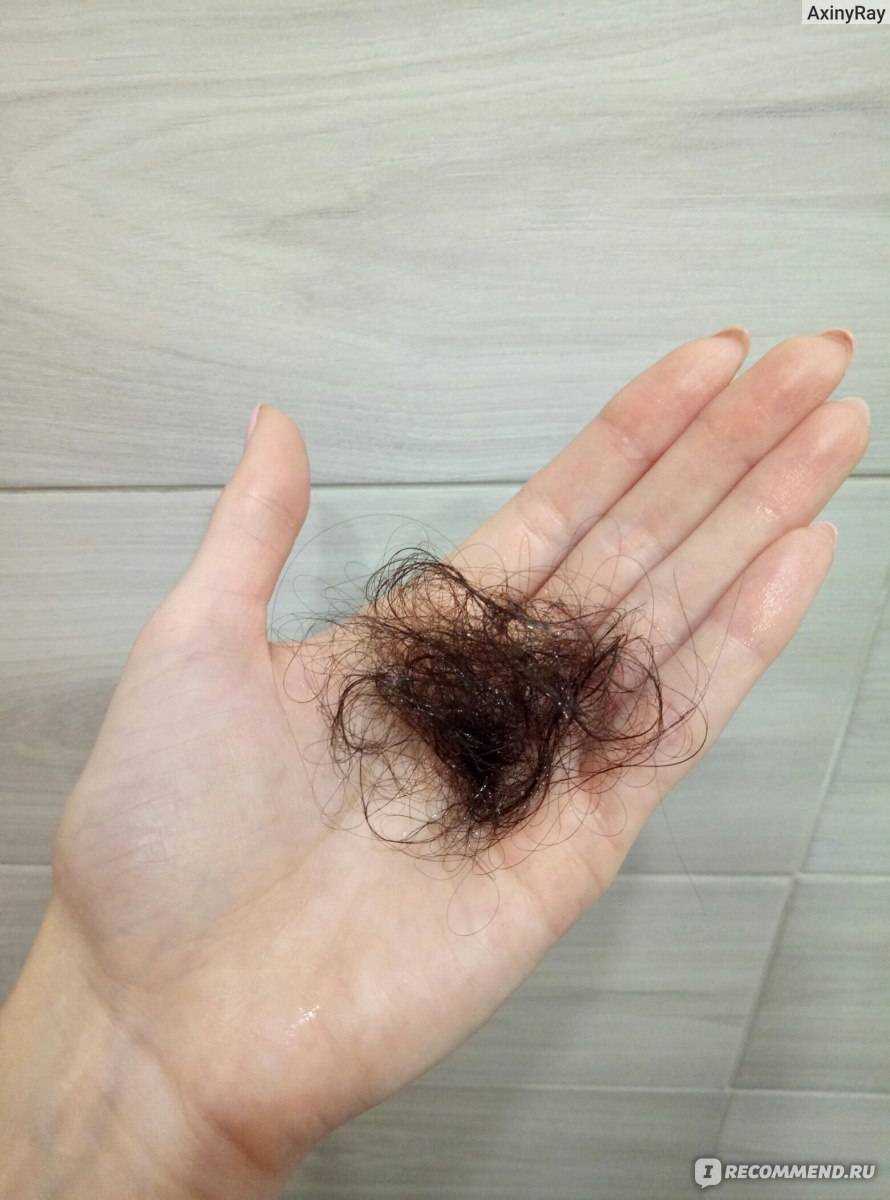 Почему выпадают волосы после мытья. Норма выпадения волос на голове.