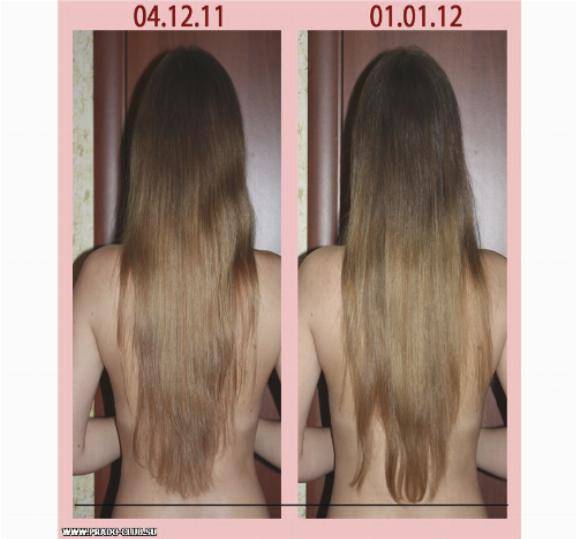 На сколько сантиметров отрастают волосы в месяц и в год?
