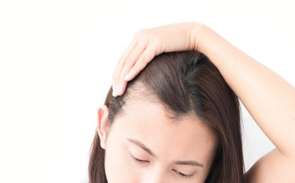 Норма выпадения волос: сколько волос выпадает в день у женщин и мужчин?