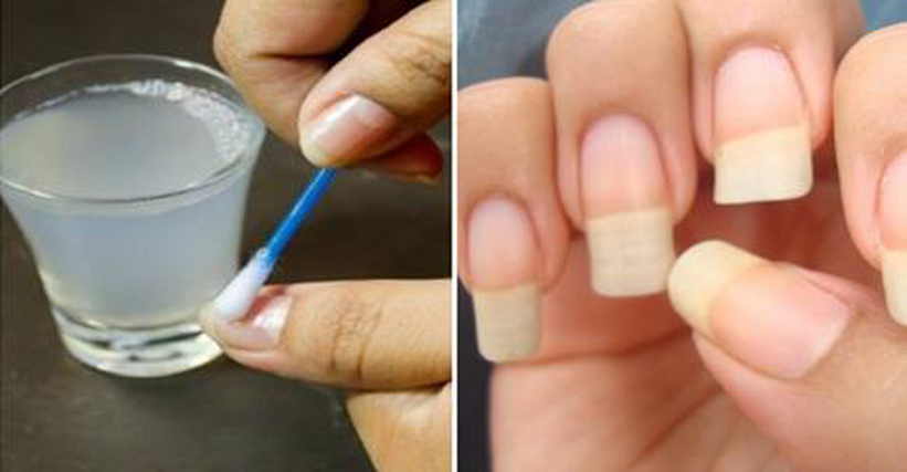 Как быстро отрастить ногти в домашних условиях на руках