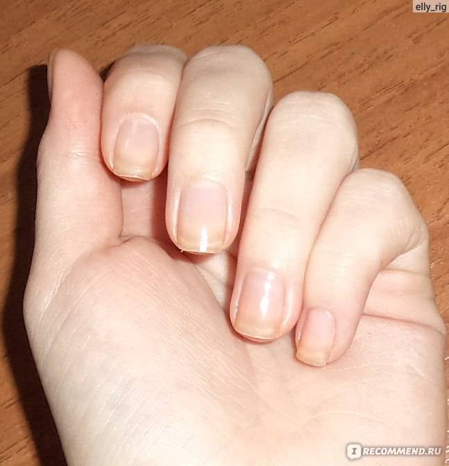 Как быстро отрастить ногти?