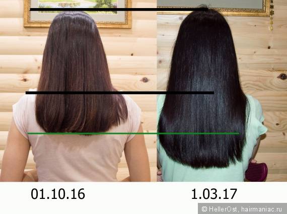 Скорость роста волос: что влияет, как усилить