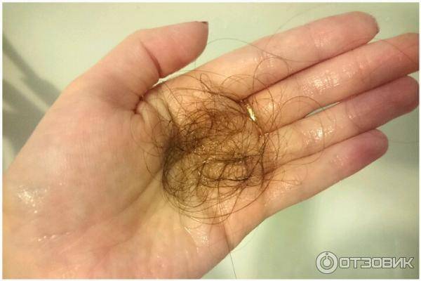 Выпадают волосы после мытья головы. Норма выпадения волос. Норма выпадения волос при мытье. Выпадают волосы при мытье. Нормальный выпавший волос.