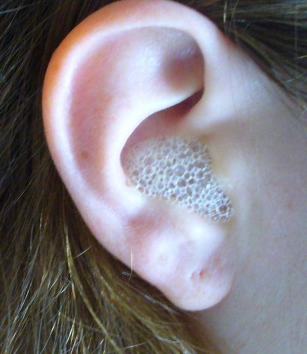 Перхоть ушная – как избавиться