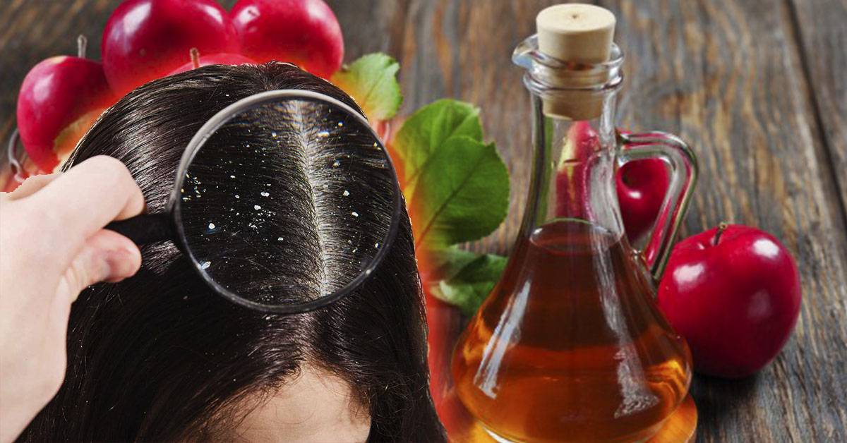 Яблочный уксус для волос. применение. как полоскать волосы яблочным уксусом?