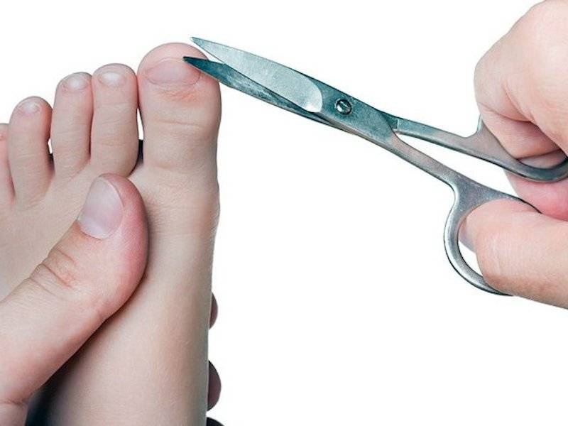 Когда можно подстригать ногти. Подстричь ногти на ногах ребенку.