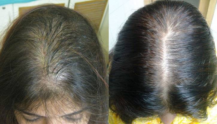 Выпадают волосы у ребенка: причины плохих волос, профилактика