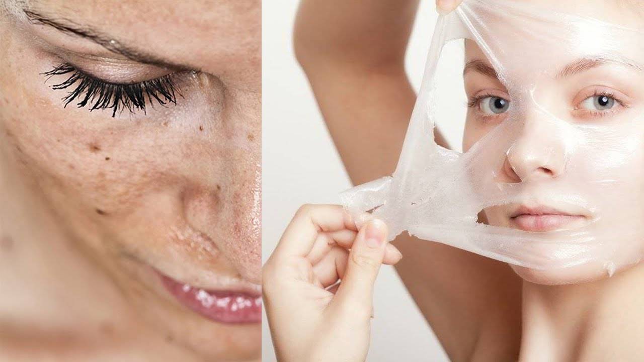 Как убрать на лице