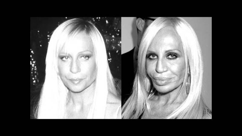 Звезды, которые сделали более 20 пластических операций