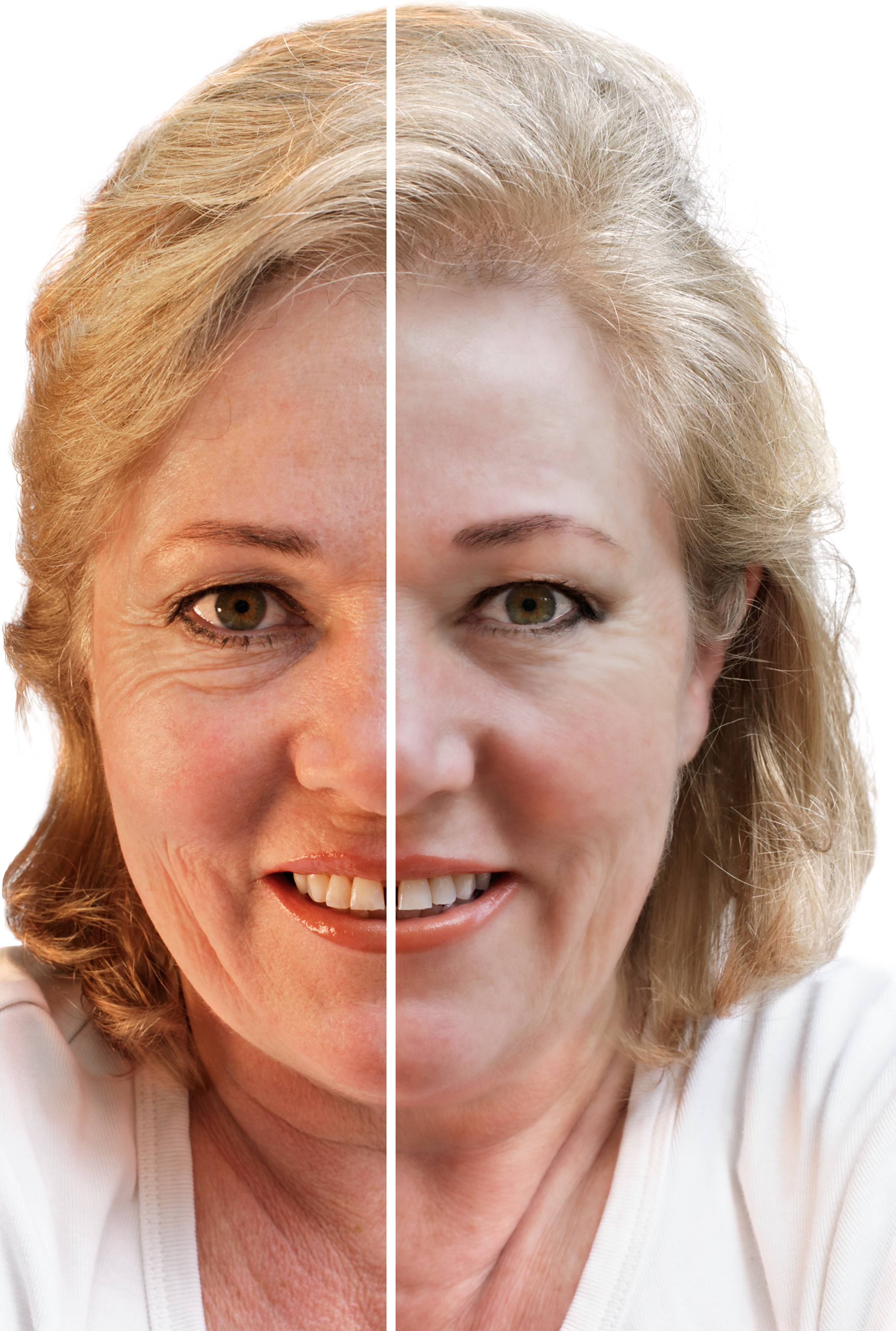 Сахарное лицо до и после отказа фото