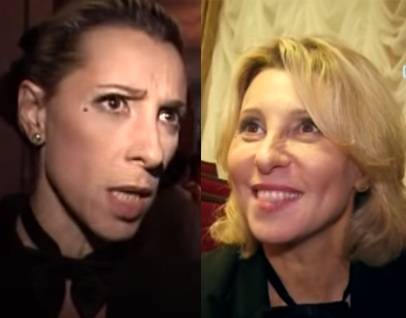 Фото звезд доказавших что ринопластика сделала их красивее