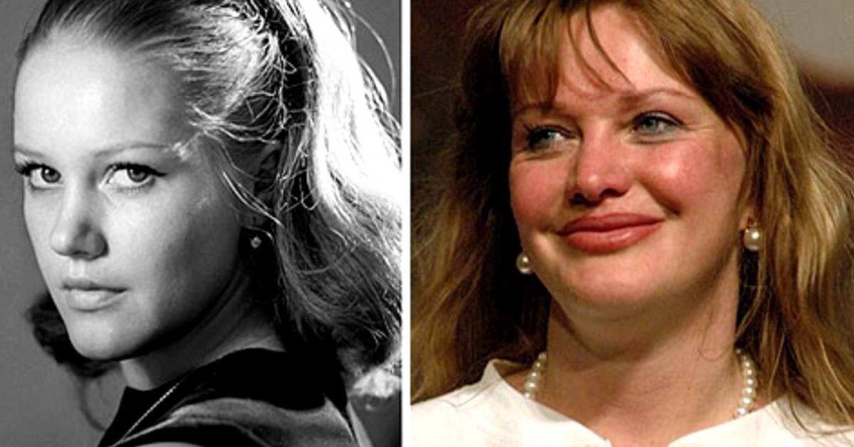 Российские звезды до и после пластики