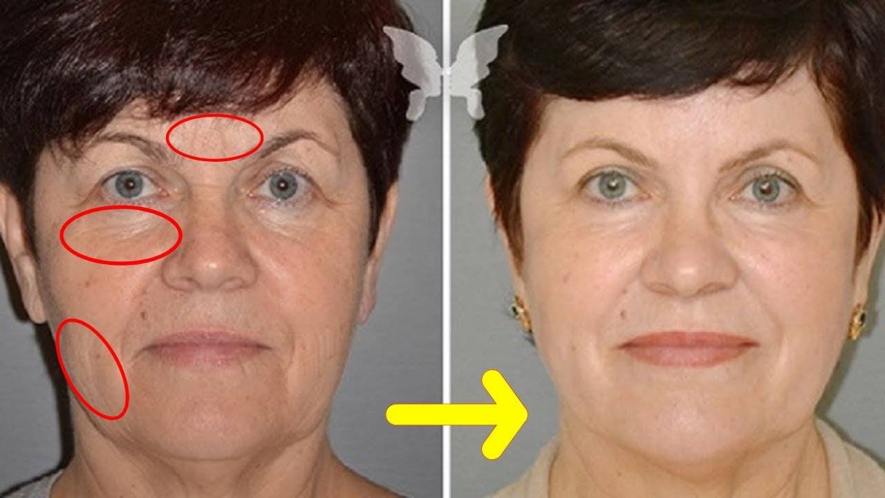 Подтяжка после 60. Омоложение лица до и после. Массаж лица до и после. Подтяжка кожи лица.