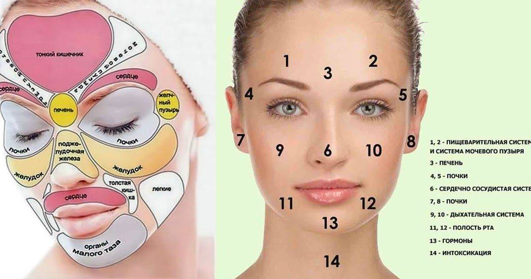 Прыщи под подбородком у женщин причины — всё о прыщах