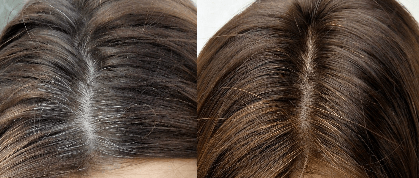 Что делать с сединой на темных волосах: советы и идеи как скрыть