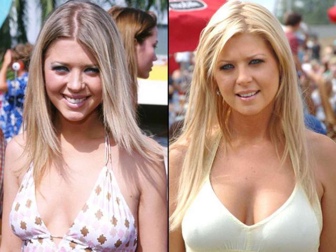 Голливудские звезды до и после пластики груди: фото до и после