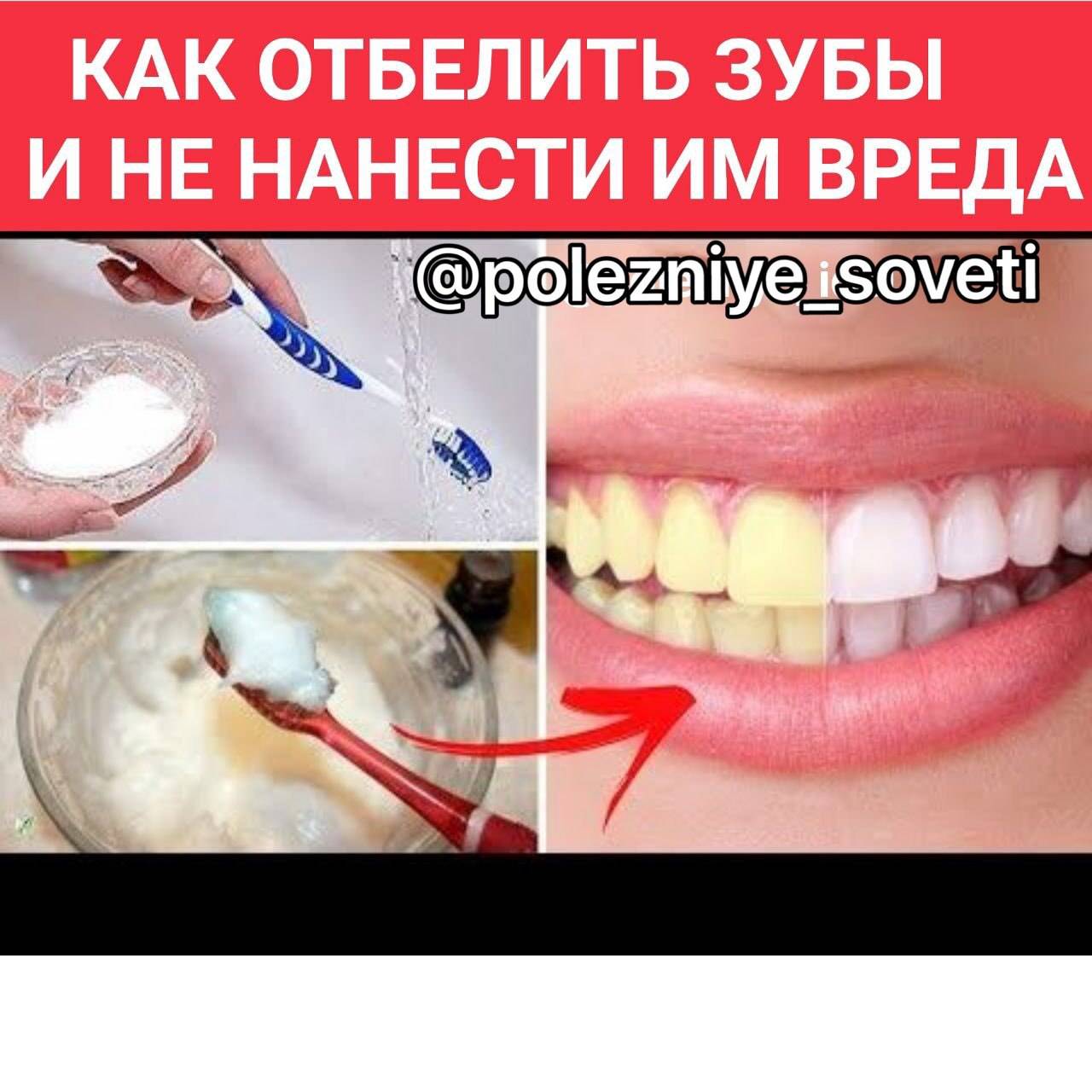 отбелить зубы на фото приложение