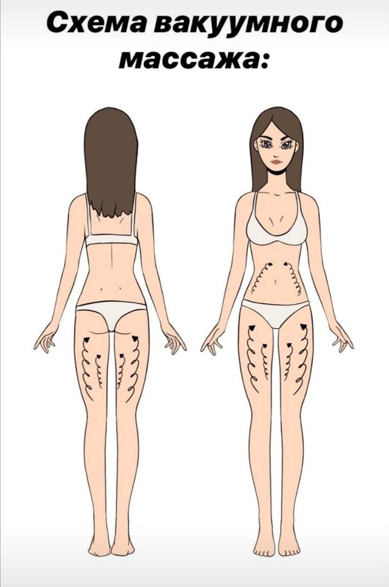 Массаж сухой щеткой при беременности можно ли. Массаж сухой щеткой схема антицеллюлитный. Лимфодренажный массаж сухой щеткой. Схема антицеллюлитного массажа щеткой. Массаж щеткой от целлюлита схема.