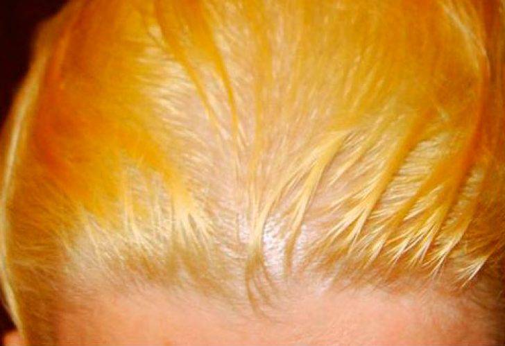 Как убрать желтизну с волос: косметические средства и домашние маски