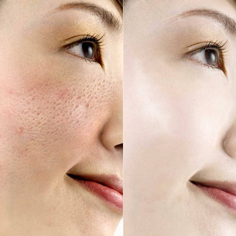 Как очистить кожу лица: 4 этапа очищения и обзор 10 средств для домашних условий