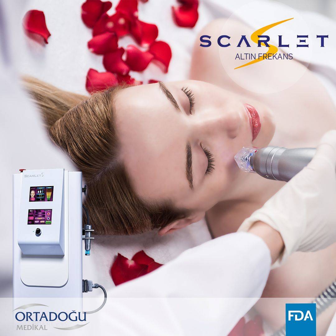 Rf-лифтинг scarlet-s: 100% молодости кожи