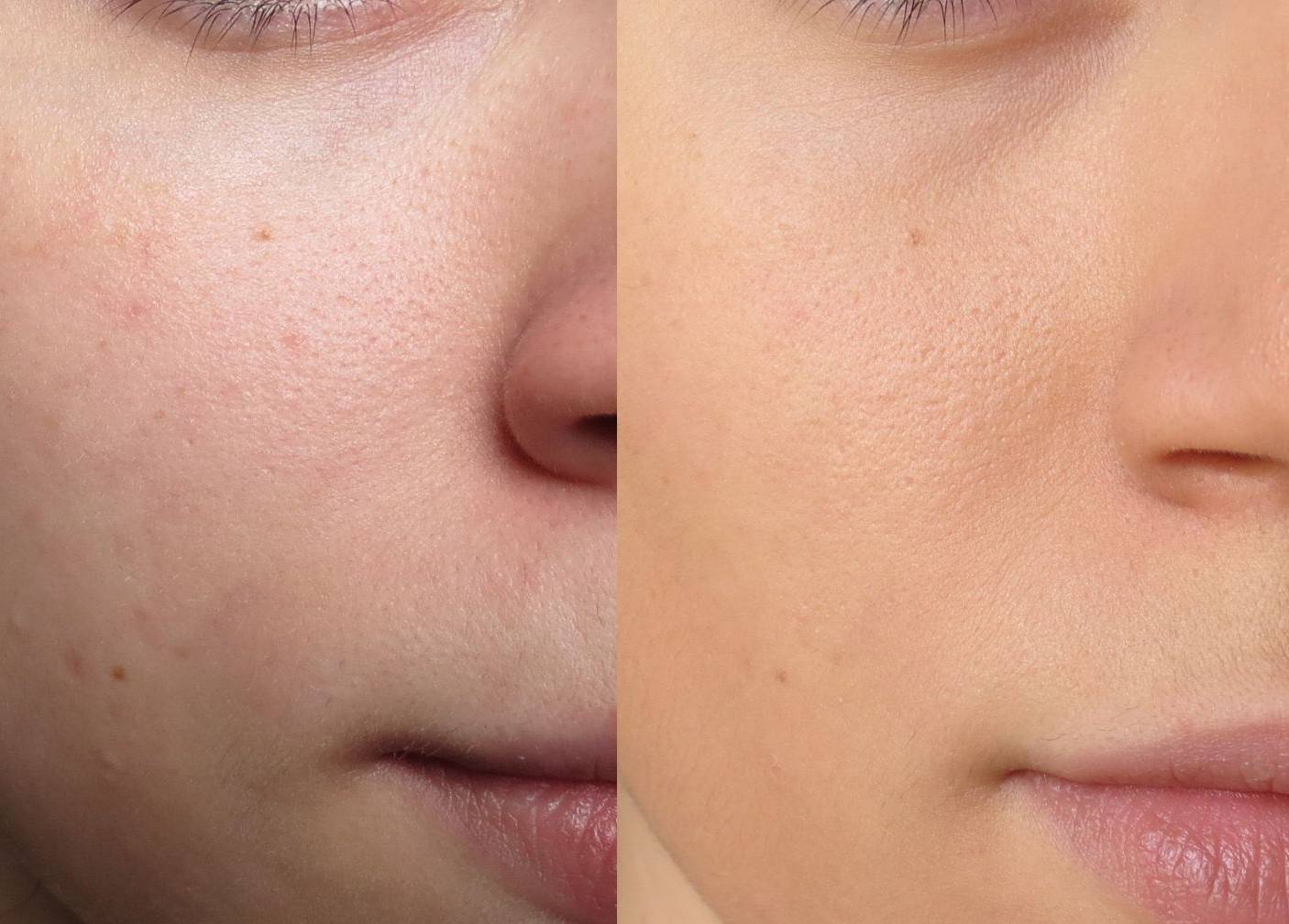 Тональный крем на лице до и после