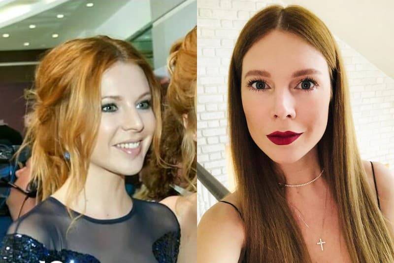 30 знаменитостей до и после пластики лица – 1st-finstep.ru