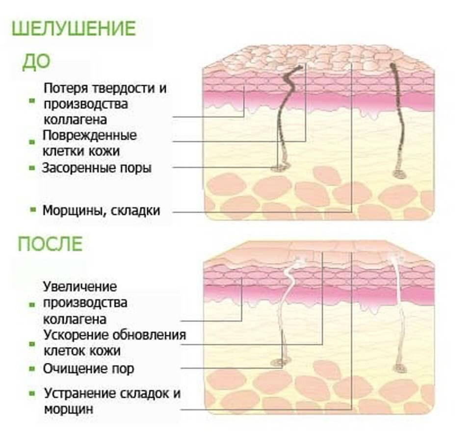 Пилинг по глубине воздействия