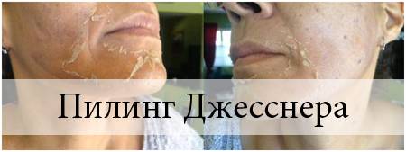 Allura esthetics (сша) - pdf скачать бесплатно