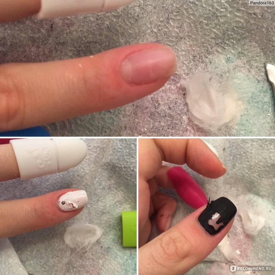 Чем покрыть ногти после геля