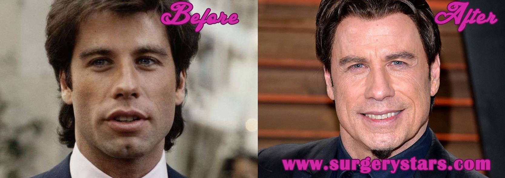 10 звезд, кому пластические операции не пошли на пользу