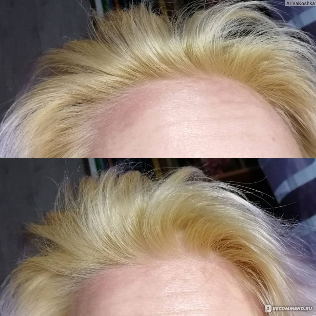 Как восстановить волосы после осветления или окрашивания