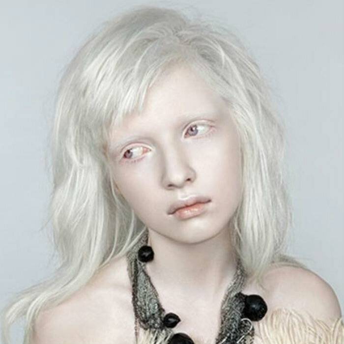 11 девушек с такой уникальной внешностью, что вам захочется взглянуть на них дважды