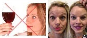 Биоревитализация и алкоголь: механизм действия и осложнения