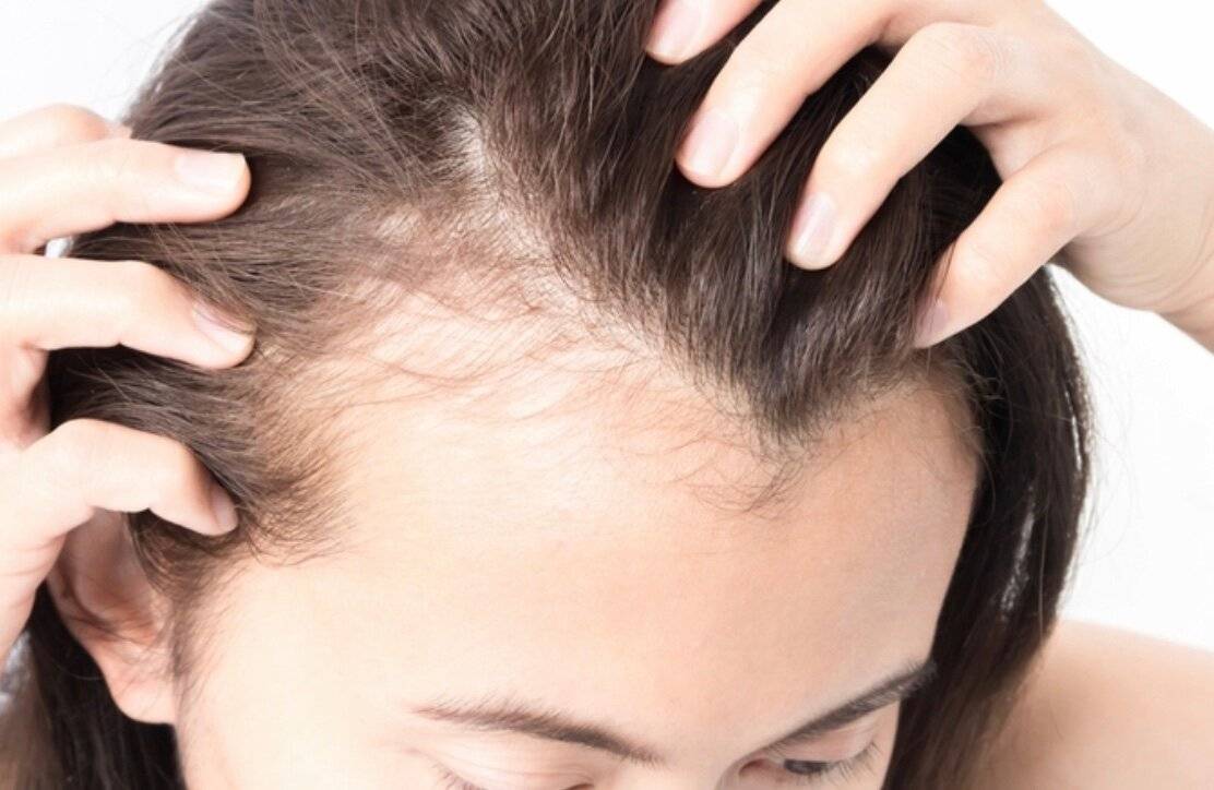 Расти коса до пояса: какие витамины необходимы для быстрого роста волос?