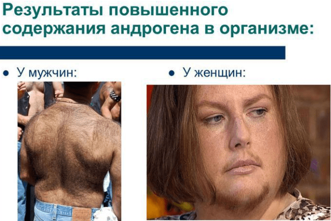 Что следует знать о гормональном сбое