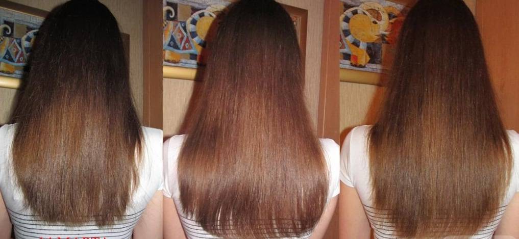 Как ускорить рост волос после ожога