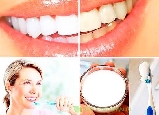 отбеливание зубов перекисью и содой дома