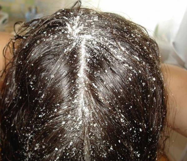 Польза скрабов для волос из морской и поваренной соли. обзор лучших средств и простые домашние рецепты