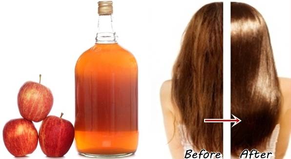 Красивые и здоровые волосы с яблочным уксусом — все тонкости применения