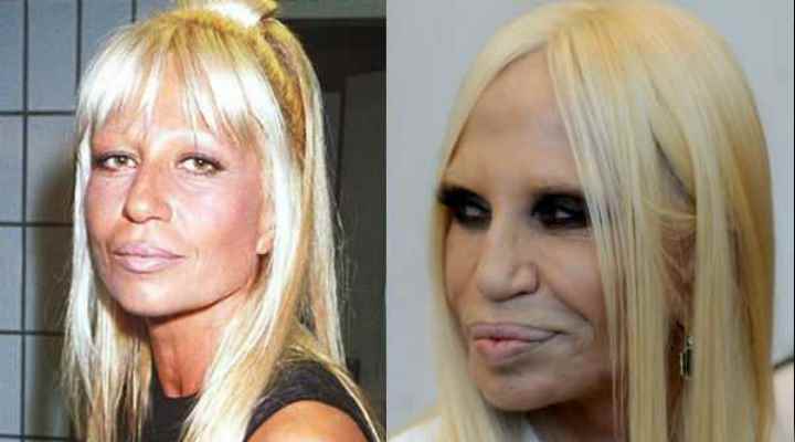 Донателла версаче- как выглядела звезда до и после пластических операций
донателла версаче: результат стремления к идеалу – womanmirror