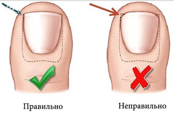 Как подстричь ногти на руках
