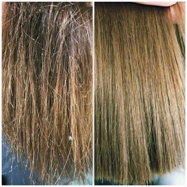 ᐉ что делать если сильно секутся волосы. как в домашних условиях вернуть здоровье и былую красоту секущимся волосам. что значит секущиеся волосы ➡ klass511.ru