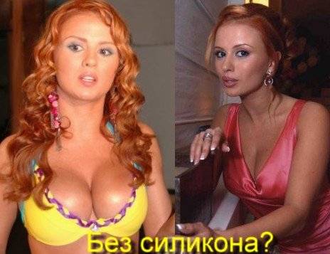 Анна семенович. фото в купальнике в молодости и сейчас. пластические операции, косметологические изменения фигуристки. отъевшая трехэтажный подбородок анна семенович пугает народ настоящей фигурой без фотошопа семенович без фотошопа толстая