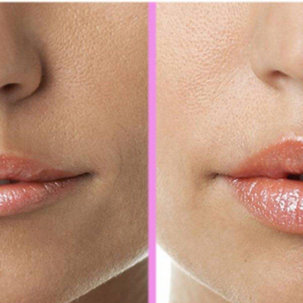 Как увеличить губы в домашних условиях: макияж, упражнения, народные средства