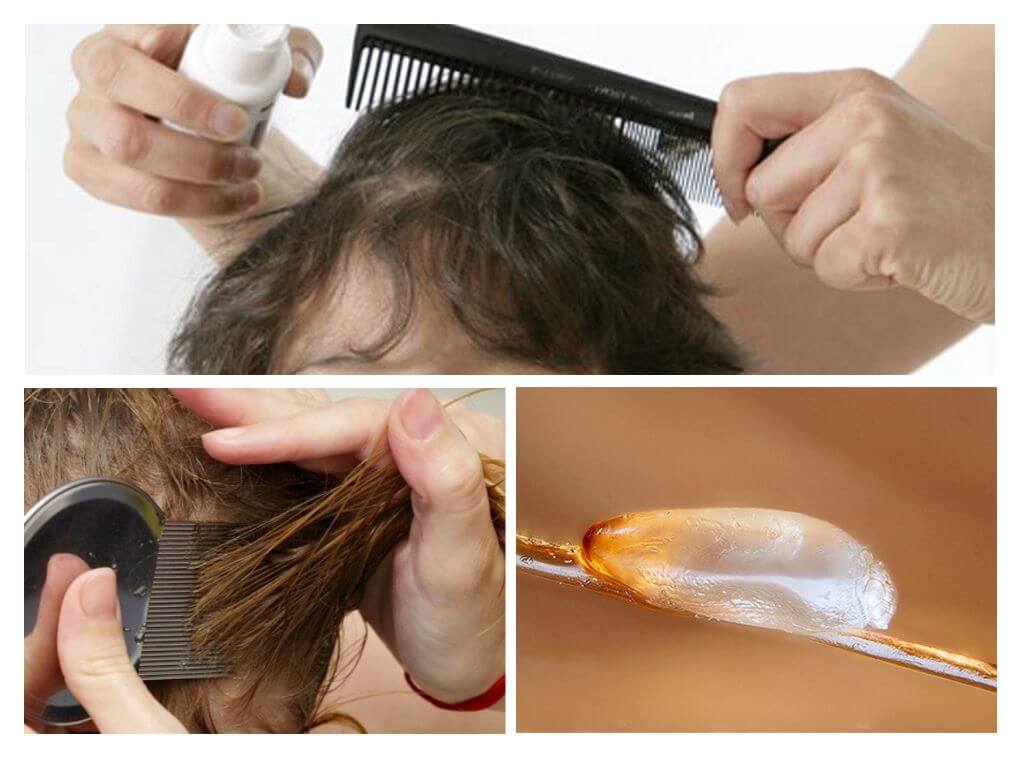 Педикулез в домашних условиях. Вычесывание вшей. Вычесывание гнид с длинных волос. Вычесывание вшей и гнид. Вычесывание волос гребнем вши.